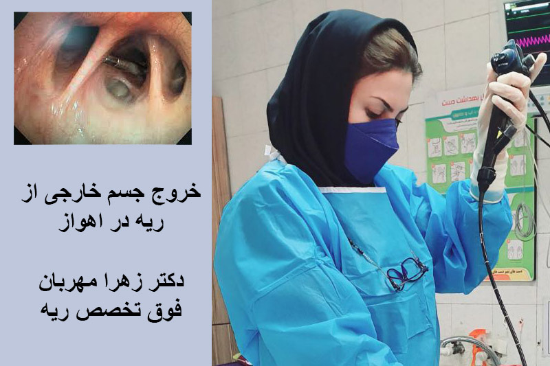 خروج جسم خارجی از ریه